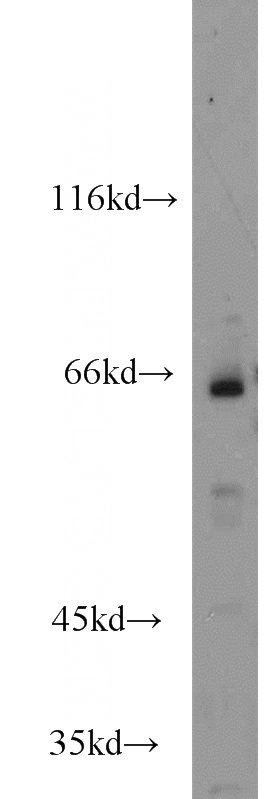 Jurkat cells were subjected to SDS PAGE followed by western blot with Catalog No:111561(HSF5 antibody) at dilution of 1:2000