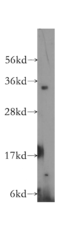 human heart tissue were subjected to SDS PAGE followed by western blot with Catalog No:114397(PSMD14 antibody) at dilution of 1:400