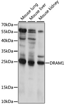 Western blot - DRAM1 Polyclonal Antibody 