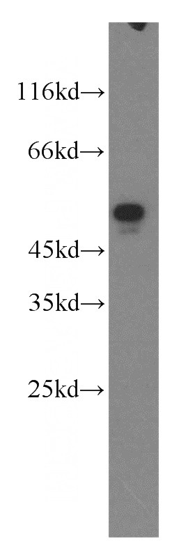 MCF7 cells were subjected to SDS PAGE followed by western blot with Catalog No:110311(EEF1A2 antibody) at dilution of 1:500
