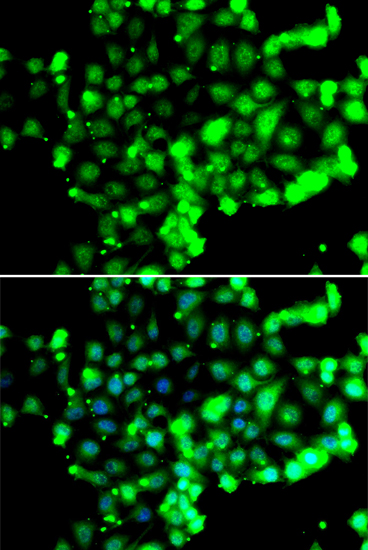 Immunofluorescence - FASTK Polyclonal Antibody 