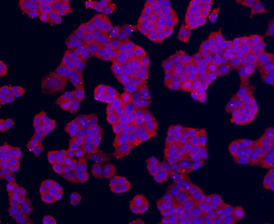Fig4: ICC staining Transmembrane protein 200A (red) in NCCIT cells. The nuclear counter stain is DAPI (blue). Cells were fixed in paraformaldehyde, permeabilised with 0.25% Triton X100/PBS.