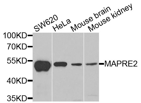 Western blot - MAPRE2 Polyclonal Antibody 