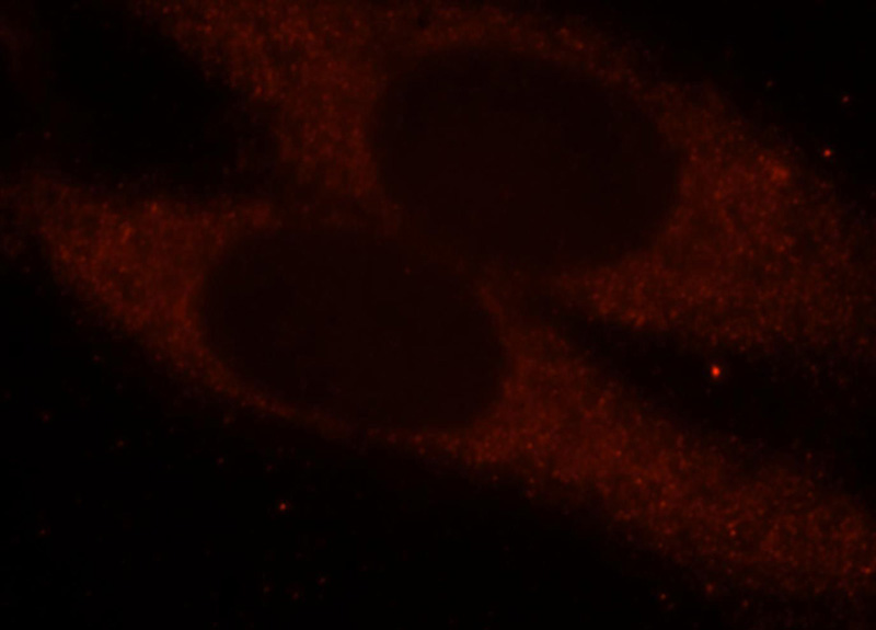Immunofluorescent analysis of HepG2 cells, using FIZ1 antibody Catalog No: at 1:25 dilution and Rhodamine-labeled goat anti-rabbit IgG (red).