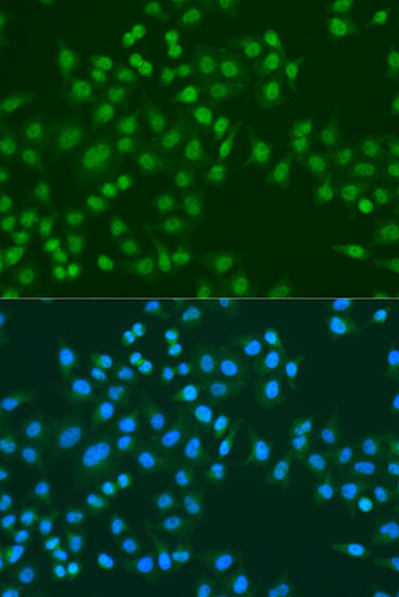 Immunofluorescence - MSI1 Polyclonal Antibody 