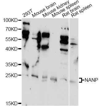Western blot - NANP Polyclonal Antibody 