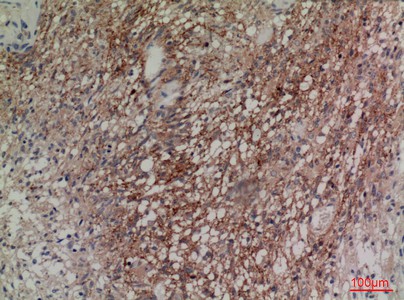 Fig2:; Immunohistochemical analysis of paraffin-embedded human-brain, antibody was diluted at 1:100