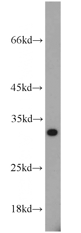 mouse spleen tissue were subjected to SDS PAGE followed by western blot with Catalog No:114246(PSME1 antibody) at dilution of 1:500