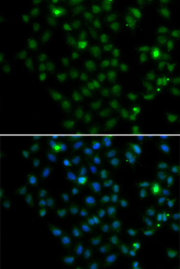 Immunofluorescence - LMO4 Polyclonal Antibody 