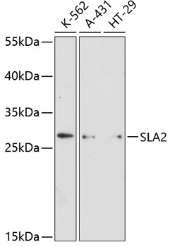 Western blot - SLA2 Polyclonal Antibody 