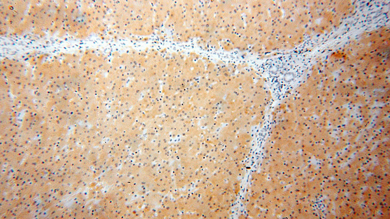 Immunohistochemical of paraffin-embedded human liver using Catalog No:111446(HPD antibody) at dilution of 1:100 (under 10x lens)
