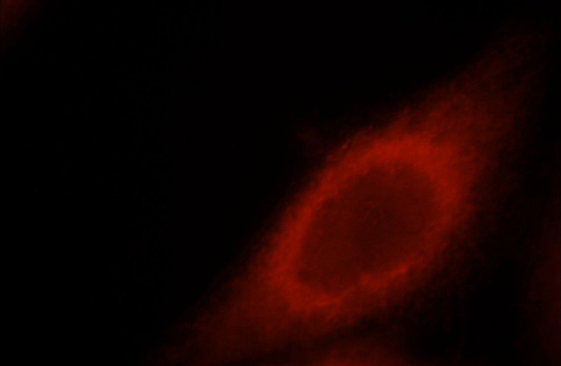 Immunofluorescent analysis of Hela cells, using STRN antibody Catalog No:115737 at 1:25 dilution and Rhodamine-labeled goat anti-rabbit IgG (red).