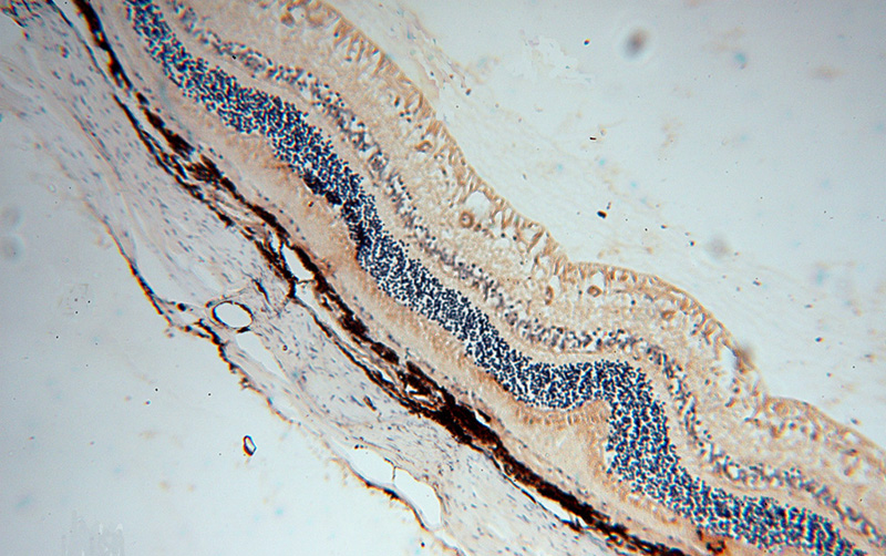 Immunohistochemical of paraffin-embedded human eye using Catalog No:107919(AIPL1 antibody) at dilution of 1:50 (under 10x lens)