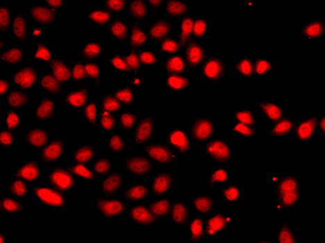 Immunofluorescence - HIF2a Polyclonal Antibody 