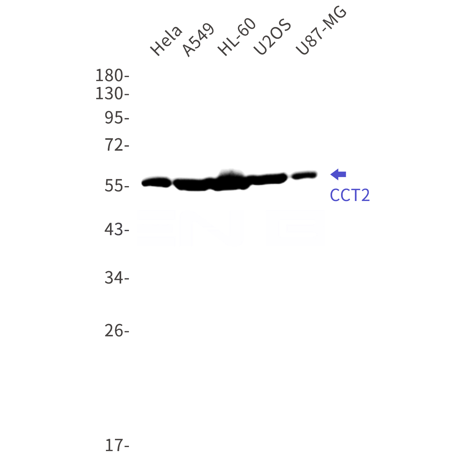 Western blot detection of CCT2 in Hela,A549,HL-60,U2OS,U87-MG cell lysates using CCT2 Rabbit mAb(1:1000 diluted).Predicted band size:57kDa.Observed band size:57kDa.
