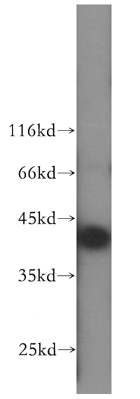 HepG2 cells were subjected to SDS PAGE followed by western blot with Catalog No:115111(SEPHS1 antibody) at dilution of 1:500