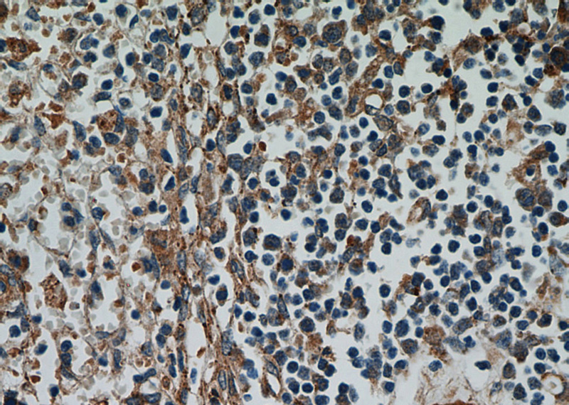 Immunohistochemical of paraffin-embedded human spleen using Catalog No:112158(LAX1 antibody) at dilution of 1:100 (under 40x lens)