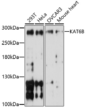 Western blot - KAT6B Polyclonal Antibody 