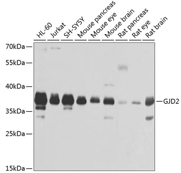 Western blot - GJD2 Polyclonal Antibody 