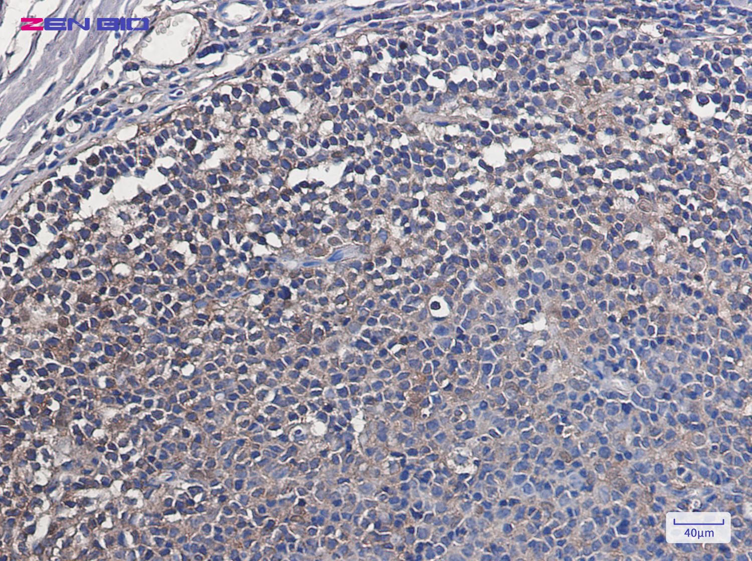 Immunohistochemistry of VCP in paraffin-embedded Human tonsil using VCP Rabbit pAb at dilution 1/20