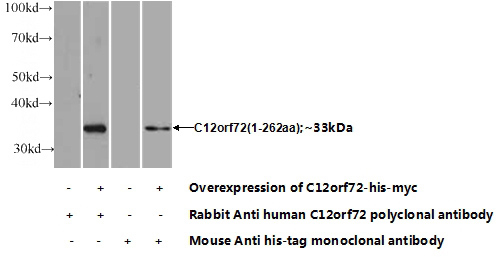 Transfected HEK-293 cells were subjected to SDS PAGE followed by western blot with Catalog No:108650(C12orf72 Antibody) at dilution of 1:700