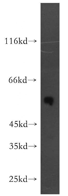 human brain tissue were subjected to SDS PAGE followed by western blot with Catalog No:115704(STEAP2-Specific antibody) at dilution of 1:500