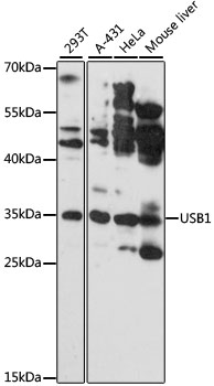 Western blot - USB1 Polyclonal Antibody 