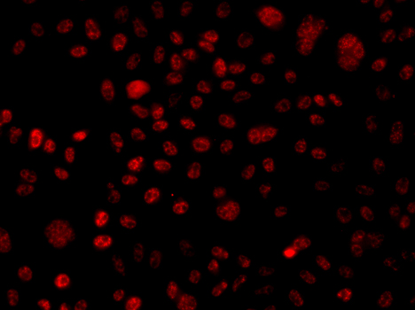 Immunofluorescence - BAF250 Polyclonal Antibody 