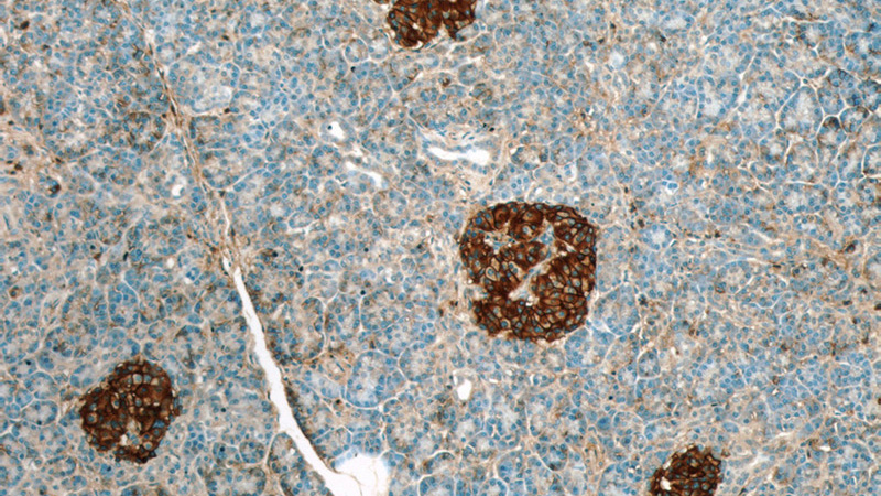 Immunohistochemistry of paraffin-embedded human pancreas slide using Catalog No:109088(CD99 Antibody) at dilution of 1:50 (under 10x lens)