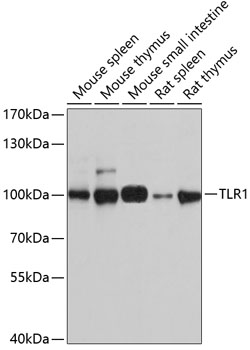 Western blot - TLR1 Polyclonal Antibody 