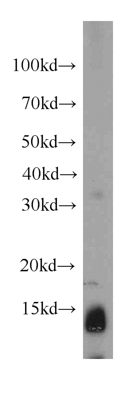 human kidney tissue were subjected to SDS PAGE followed by western blot with Catalog No:113080(NDUFC2 antibody) at dilution of 1:500