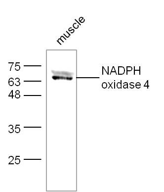 Anti-Nox4 antibody