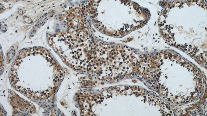Immunohistochemical of paraffin-embedded human testis using Catalog No:114492(ZFYVE20 antibody) at dilution of 1:50 (under 10x lens)
