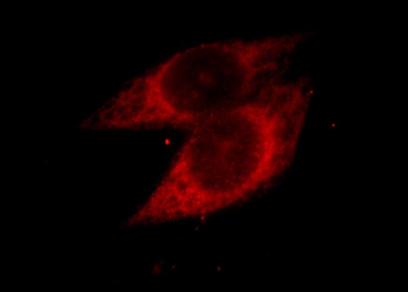 Immunofluorescent analysis of Hela cells, using PARP3 antibody Catalog No:113594 at 1:25 dilution and Rhodamine-labeled goat anti-rabbit IgG (red).