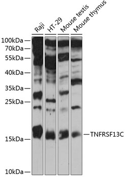 Western blot - TNFRSF13C Polyclonal Antibody 