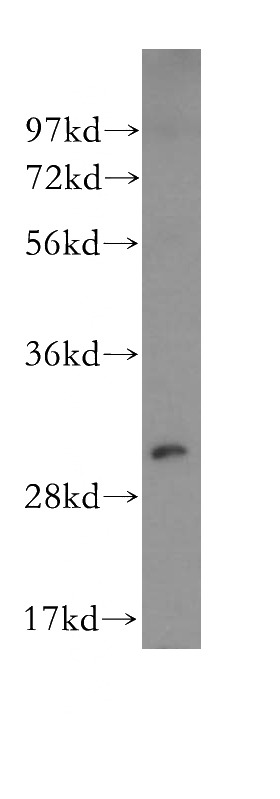 K-562 cells were subjected to SDS PAGE followed by western blot with Catalog No:113227(NQO1 antibody) at dilution of 1:500
