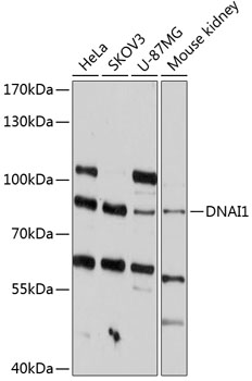 Western blot - DNAI1 Polyclonal Antibody 
