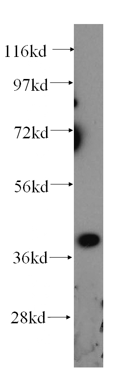 A375 cells were subjected to SDS PAGE followed by western blot with Catalog No:110835(GALE antibody) at dilution of 1:300