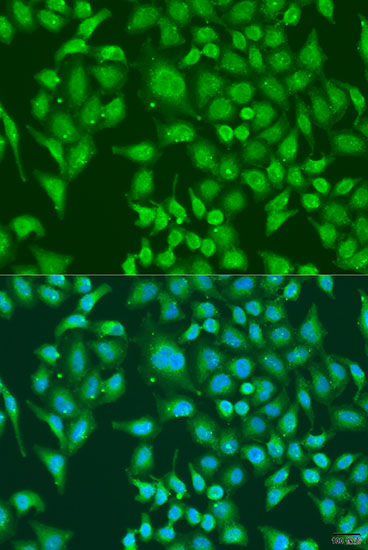 Immunofluorescence - CENPQ Polyclonal Antibody 