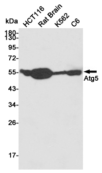 Western blot detection of Atg5 in HCT116,Rat Brain,K562 and C6 cell lysates using Atg5 mouse mAb (1:1000 diluted).Predicted band size:55KDa.Observed band size:55KDa.