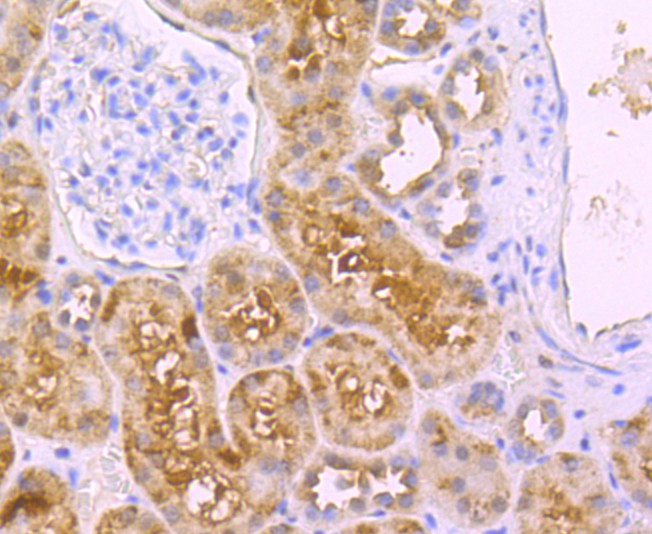 Fig6:; Immunohistochemical analysis of paraffin-embedded human kidney tissue using anti-DLL4 antibody. The section was pre-treated using heat mediated antigen retrieval with Tris-EDTA buffer (pH 9.0) for 20 minutes.The tissues were blocked in 1% BSA for 30 minutes at room temperature, washed with ddH; 2; O and PBS, and then probed with the primary antibody ( 1/50) for 30 minutes at room temperature. The detection was performed using an HRP conjugated compact polymer system. DAB was used as the chromogen. Tissues were counterstained with hematoxylin and mounted with DPX.