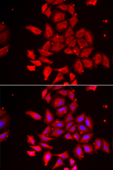 Immunofluorescence - TMOD4 Polyclonal Antibody 