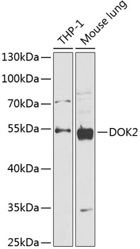 Western blot - DOK2 Polyclonal Antibody 