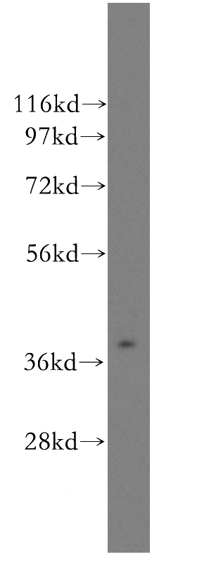 human liver tissue were subjected to SDS PAGE followed by western blot with Catalog No:108227(ASGR2 antibody) at dilution of 1:400