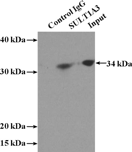 IP Result of anti-SULT1A3 (IP:Catalog No:115826, 4ug; Detection:Catalog No:115826 1:200) with COLO 320 cells lysate 2240ug.