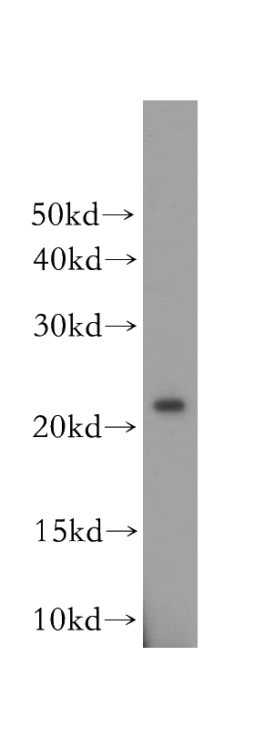 COLO 320 cells were subjected to SDS PAGE followed by western blot with Catalog No:113463(OBFC2A antibody) at dilution of 1:500