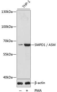 Western blot - SMPD1 / ASM Polyclonal Antibody 