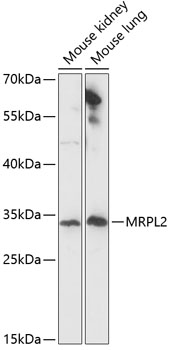 Western blot - MRPL2 Polyclonal Antibody 