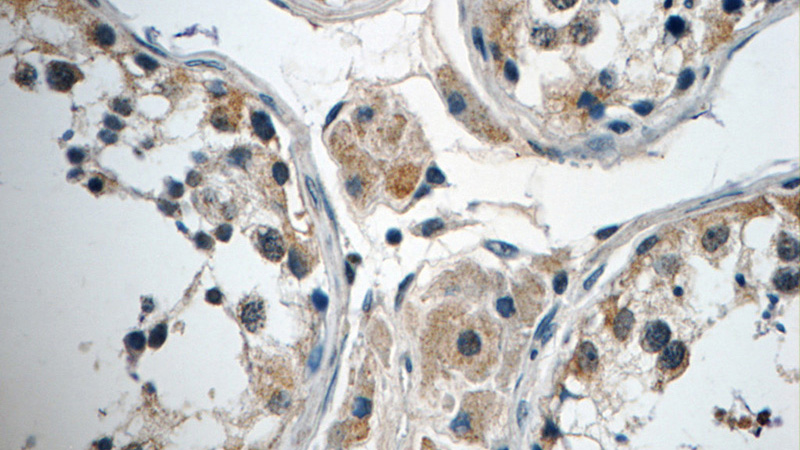 Immunohistochemistry of paraffin-embedded human testis tissue slide using Catalog No:108075(ANKRD33 Antibody) at dilution of 1:50 (under 40x lens)