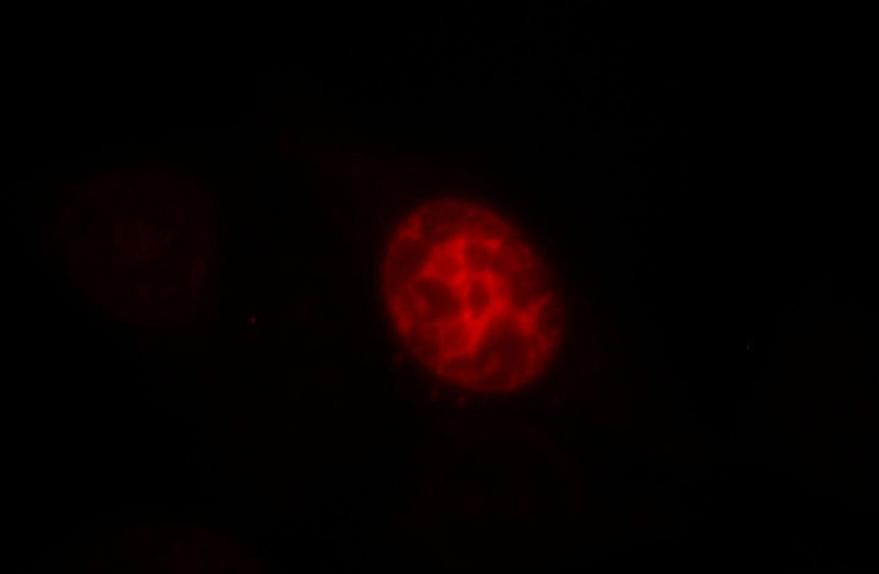 Immunofluorescent analysis of HepG2 cells, using TPX2 antibody Catalog No:116223 at 1:25 dilution and Rhodamine-labeled goat anti-rabbit IgG (red).